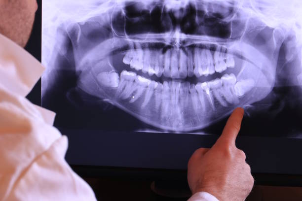 Best Emergency Denture Repair in Slaton, TX